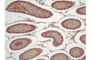 IHC analysis of HOOK3 using anti-HOOK3 antibody (ABIN6719547).