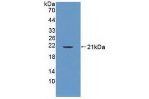 Detection of Recombinant PTPN13, Human using Polyclonal Antibody to Protein Tyrosine Phosphatase, Non Receptor Type 13 (PTPN13) (PTPN13 抗体  (AA 1-161))