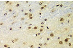 Immunohistochemistry (Paraffin-embedded Sections) (IHC (p)) image for anti-Ring Finger Protein 2 (RNF2) antibody (ABIN7010707)