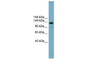 ASXL2 antibody used at 1 ug/ml to detect target protein. (ASXL2 抗体)