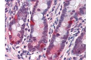 Image no. 1 for anti-Nucleotide-Binding Oligomerization Domain Containing 2 (NOD2) (C-Term) antibody (ABIN372922) (NOD2 抗体  (C-Term))