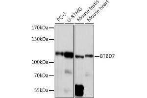 Western blot analysis of extracts of various cell lines, using BTBD7 Rabbit pAb (ABIN7265954) at 1:1000 dilution. (BTBD7 抗体)