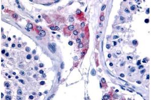 Anti-ESRRB antibody  ABIN1048582 IHC staining of human testis. (ESRRB 抗体  (Internal Region))