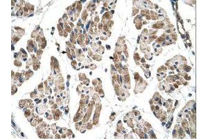 Image no. 1 for anti-Integrin beta 1 Binding Protein (Melusin) 2 (ITGB1BP2) (N-Term) antibody (ABIN204995) (ITGB1BP2 抗体  (N-Term))
