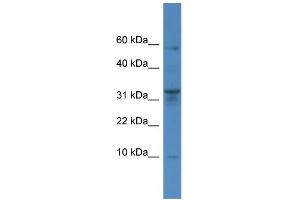 WB Suggested Anti-CTSC Antibody Titration: 0. (CTSC 抗体  (Middle Region))