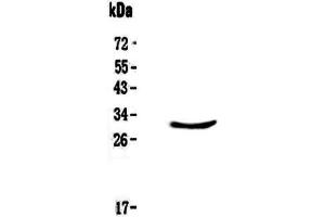 Western Blotting (WB) image for anti-ClpP Caseinolytic Peptidase, ATP-Dependent, Proteolytic Subunit Homolog (E. Coli) (CLPP) (AA 184-247) antibody (ABIN5693176)