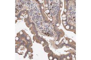 Immunohistochemical staining of human duodenum with B3GNTL1 polyclonal antibody  shows moderate cytoplasmic positivity in glandular cells. (B3GNTL1 抗体)
