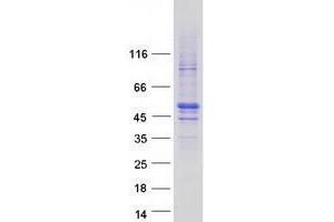 Western Blotting (WB) image for Zinc Finger, HIT-Type Containing 2 (ZNHIT2) protein (Myc-DYKDDDDK Tag) (ABIN2736143)