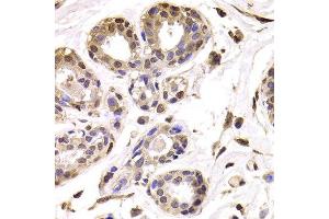 Immunohistochemistry of paraffin-embedded Human mammary gland using BAP1 antibody at dilution of 1:100 (x400 lens). (BAP1 抗体)