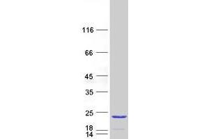 Validation with Western Blot