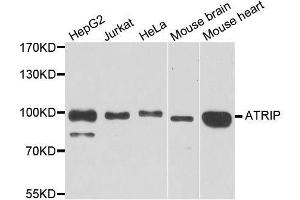 Western blot analysis of extracts of various cell lines, using ATRIP antibody. (ATRIP 抗体  (AA 1-260))
