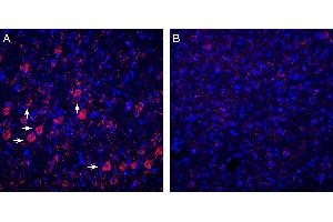 Expression of P2Y6 in rat cortex. (P2RY6 抗体  (C-Term, Intracellular))