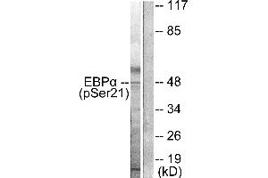 Western blot analysis of extracts from HepG2 cells treated with EGF (200ng/ml, 5mins), using C/EBP-α (phospho-Ser21) antibody. (CEBPA 抗体  (pSer21))