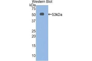 Detection of Recombinant aFP, Rat using Polyclonal Antibody to Alpha-Fetoprotein (AFP) (alpha Fetoprotein 抗体  (AA 409-611))
