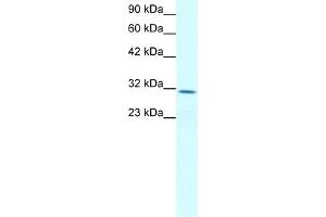 WB Suggested Anti-CLDN17 Antibody Titration:  2. (Claudin 17 抗体  (Middle Region))