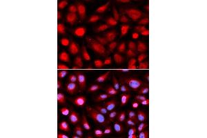 Immunofluorescence analysis of U2OS cell using RPL5 antibody. (RPL5 抗体  (AA 1-95))