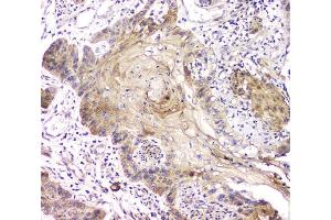 IHC analysis of RAB11B using anti-RAB11B antibody (ABIN6719364).