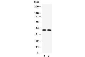 Western blot testing of IRF2 antibody and Lane 1:  HeLa (IRF2 抗体  (C-Term))