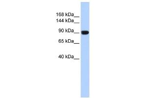 WB Suggested Anti-TMEM16A Antibody Titration:  0. (ANO1 抗体  (Middle Region))