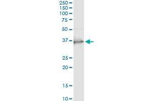 Immunoprecipitation of SCP2 transfected lysate using anti-SCP2 monoclonal antibody and Protein A Magnetic Bead , and immunoblotted with SCP2 MaxPab rabbit polyclonal antibody. (SCP2 抗体  (AA 1-143))