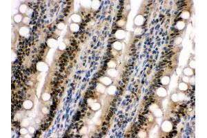 Immunohistochemistry (Paraffin-embedded Sections) (IHC (p)) image for anti-Mitogen-Activated Protein Kinase 13 (MAPK13) (AA 332-365), (C-Term) antibody (ABIN3043610) (MAPK13 抗体  (C-Term))