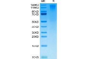 SDS-PAGE (SDS) image for CD96 (CD96) (AA 22-503) protein (His-Avi Tag,Biotin) (ABIN7274274)