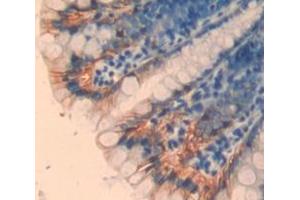 IHC-P analysis of Kidney tissue, with DAB staining. (TPSB2 抗体  (AA 30-276))