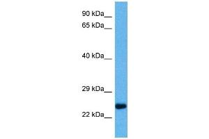 Host:  Mouse  Target Name:  PLP1  Sample Tissue:  Mouse Heart  Antibody Dilution:  1ug/ml (PLP1 抗体  (Middle Region))