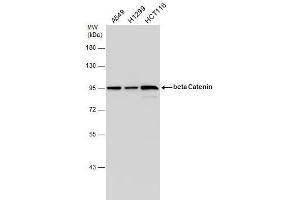 WB Image beta Catenin antibody [N1N2-2], N-term detects beta Catenin protein by western blot analysis. (CTNNB1 抗体  (N-Term))