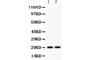 Anti-HSPB2 Picoband antibody, Western blottingAll lanes: Anti HSPB2  at 0. (HSPB2 抗体  (AA 1-182))