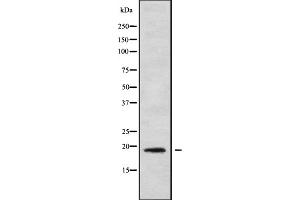 Western blot analysis IL1F9 using COLO205 whole cell lysates (IL1F9 抗体  (N-Term))
