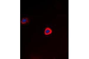 Immunofluorescent analysis of PAK1 (pT212) staining in Hela cells. (PAK1 抗体  (pSer212))