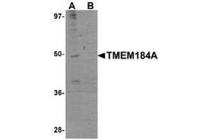 Western blot analysis in rat brain tissue lysate with TMEM184A Antibody  at 1 μg/ml in the absence (A) and the presence (B) of blocking peptide. (TMEM184A 抗体  (C-Term))