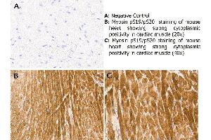 Immunohistochemistry with anti-myosin pS19/pS20 antibody showing strong cytoplasmic staining of myocytes in mouse heart muscle 20x and 40x (B & C). (Myosin 抗体  (pSer19, pSer20))
