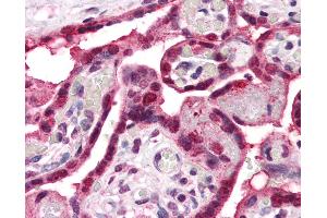 Anti-ENT1 antibody IHC of human placenta. (SLC29A1 抗体  (Internal Region))