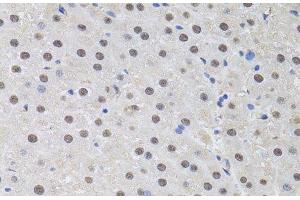 Immunohistochemistry of paraffin-embedded Rat liver using HUS1 Polyclonal Antibody at dilution of 1:100 (40x lens). (HUS1 抗体)