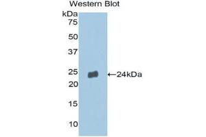 Western Blotting (WB) image for anti-Matrix Metallopeptidase 13 (Collagenase 3) (MMP13) (AA 290-468) antibody (ABIN1859847) (MMP13 抗体  (AA 290-468))