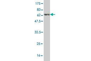 Western Blot detection against Immunogen (61. (Annexin A3 抗体  (AA 1-323))
