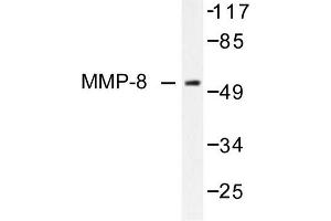 Image no. 1 for anti-Matrix Metallopeptidase 8 (Neutrophil Collagenase) (MMP8) antibody (ABIN265533) (MMP8 抗体)