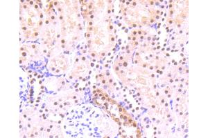 Immunohistochemistry (Paraffin-embedded Sections) (IHC (p)) image for anti-Signal Transducer and Activator of Transcription 3 (Acute-Phase Response Factor) (STAT3) (pSer727) antibody (ABIN5557530)