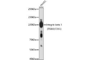 Western blot analysis of extracts of HUVEC cells, using Integrin beta 3 (ITGB3/CD61) antibody (ABIN6127572, ABIN6142584, ABIN6142586 and ABIN6219636) at 1:1000 dilution. (Integrin beta 3 抗体  (AA 610-718))