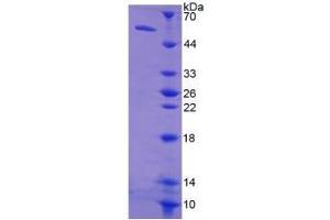 SDS-PAGE of Protein Standard from the Kit (Highly purified E. (TK1 ELISA 试剂盒)
