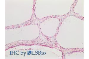 ABIN6391343 (5µg/ml) staining of paraffin embedded Human Thyroid.