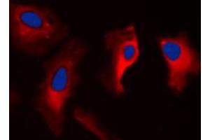 Immunofluorescent analysis of 14-3-3 zeta staining in MCF7 cells. (14-3-3 zeta 抗体  (C-Term))