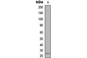 Western blot analysis of IL-12A expression in MDA-MB231 (A) whole cell lysates. (IL12A 抗体  (Center))