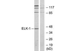 Western blot analysis of extracts from HeLa cells, treated with heat shock, using Elk1 (Ab-389) Antibody. (ELK1 抗体  (AA 356-405))