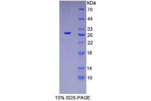 SDS-PAGE analysis of Human HNF4a Protein. (HNF4A 蛋白)
