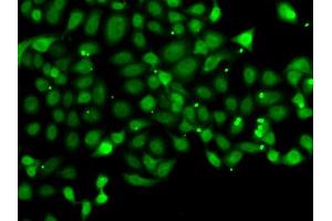 Immunofluorescence analysis of MCF7 cell using PDCD5 antibody. (PDCD5 抗体)