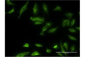 Immunofluorescence of monoclonal antibody to ETNK1 on HeLa cell. (Ethanolamine Kinase 1 抗体  (AA 133-228))