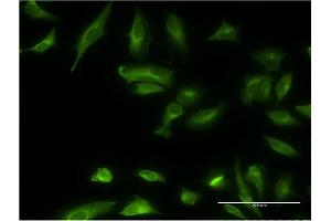 Immunofluorescence of monoclonal antibody to ETNK1 on HeLa cell. (Ethanolamine Kinase 1 抗体  (AA 133-228))